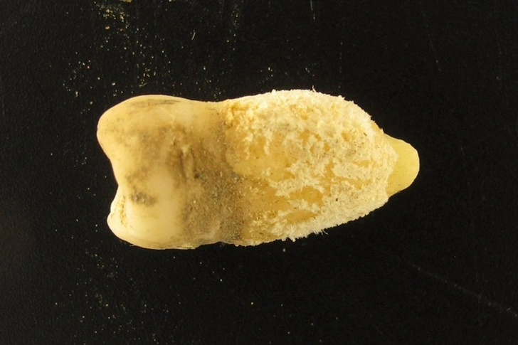 Колумб ни в чем не виноват: зуб боливийской мумии переписал историю скарлатины